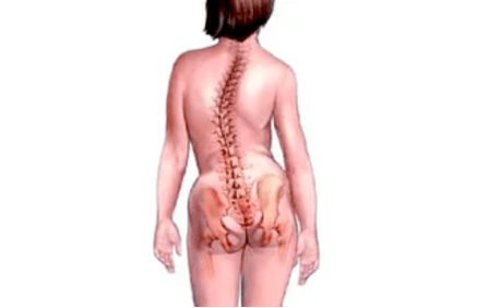 The reasons for the development of cervix osteochondrosis