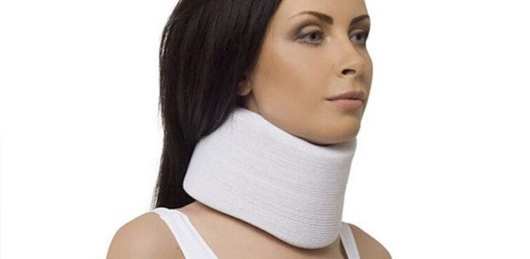 The shants collar fixes the vertebrae in exacerbation of cervical osteochondrosis