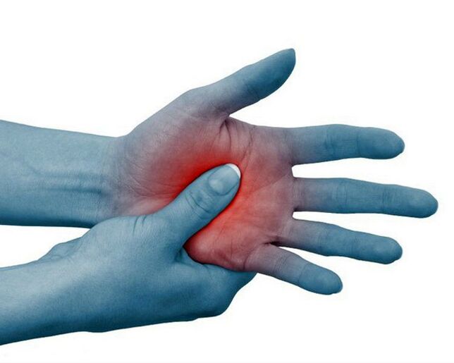 Severe pain in the finger joints that eases with physical activity is a typical sign of rheumatoid arthritis. 