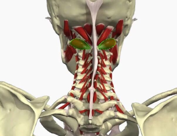 Vail arteries syndrome